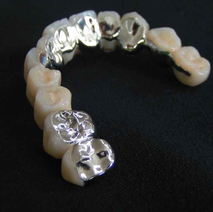 Abnehmbare Brücke (1)