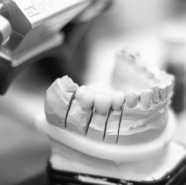 tooth-replacement-3532981_1920